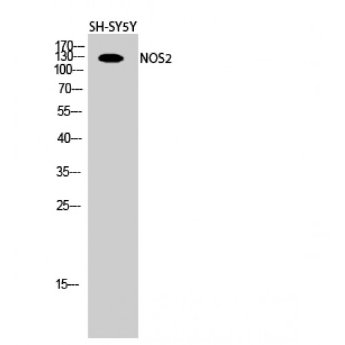 NOS2 / iNOS Antibody - Western blot of NOS2 antibody