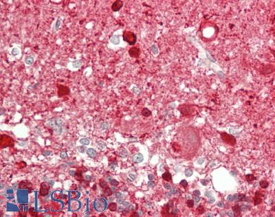 NOS2 / iNOS Antibody - Human Brain, Cerebellum: Formalin-Fixed, Paraffin-Embedded (FFPE)