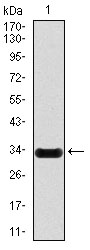 NOS2 / iNOS Antibody - Western blot using NOS2 monoclonal antibody against human NOS2 (AA: 997-1058) recombinant protein. (Expected MW is 32.6 kDa)