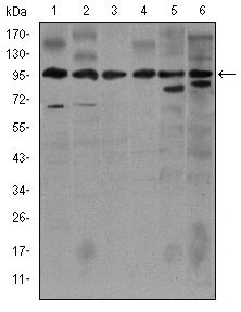 NOS2 / iNOS Antibody - Western blot using NOS2 mouse monoclonal antibody against Jurkat (1), Jurkat (2), A549 (3), HeLa (4), NIH3T3 (5)and MCF-7 (6) cell lysate.
