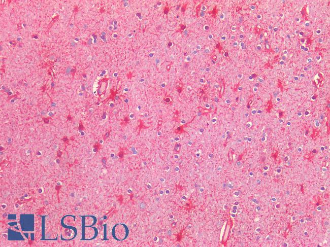 NOS2 / iNOS Antibody - Human Brain, Cortex: Formalin-Fixed, Paraffin-Embedded (FFPE)