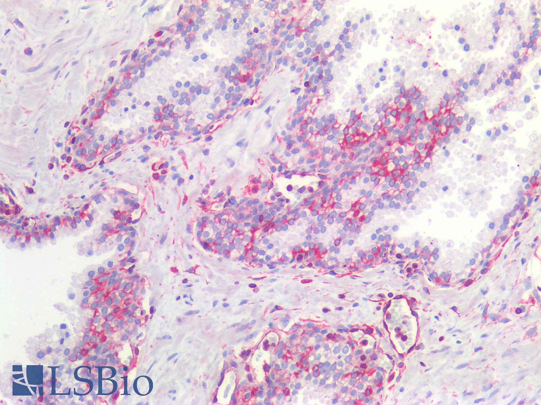 NOS2 / iNOS Antibody - Human Prostate: Formalin-Fixed, Paraffin-Embedded (FFPE)