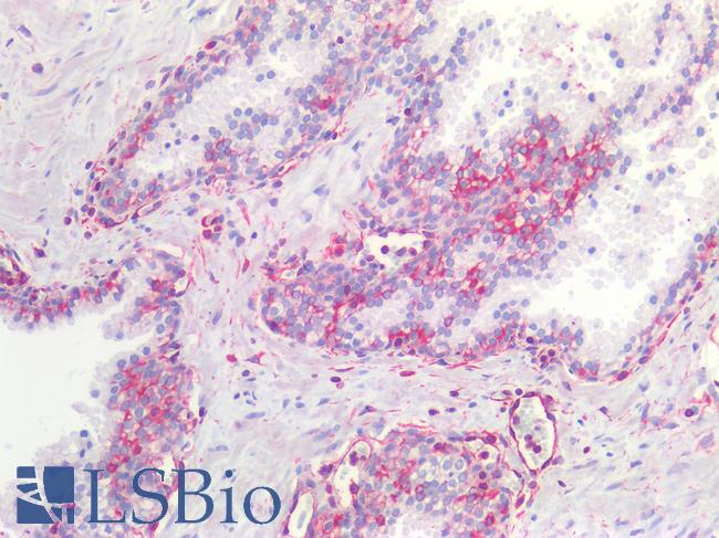 NOS2 / iNOS Antibody - Human Prostate: Formalin-Fixed, Paraffin-Embedded (FFPE)