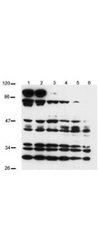 NOTCH2 Antibody - Anti-Notch 2 Antibody - Western Blot. Western blot of anti-Notch 2 (intra) antibody shows detection of a band at ~110 kD corresponding to active Notch 2 protein (arrowhead). Western Blot analysis was performed for Notch 2 expression using 100 ug of total protein lysate obtained from human mesothelial SV40 cells transfected with a plasmid encoding a constitutively active Notch 2 (intra cellular Notch 2). Lanes 1-3 contain lysate 24 h (1), 48 h (2), and 72 h (3) post transfection. Lanes 4-6 are the corresponding control cells (untransfected) taken at similar time points. The band at about 110kD represents active Notch 2. This band is not seen in the control cell. The intracellular domain of Notch 2 has a predicted band size of 110kD, corresponding to this band. Protein cell lysates were run on a 10% SDS-page gel, blotted onto Hybond C membrane, blocked overnight in PBS-Tween 20 supplemented with 5% Non-fat Milk and probed with anti-Notch 2 at a 1:400 dilution. ECL was used as visualization method.
