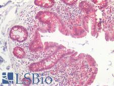 NOX1 Antibody - Human Small Intestine: Formalin-Fixed, Paraffin-Embedded (FFPE)