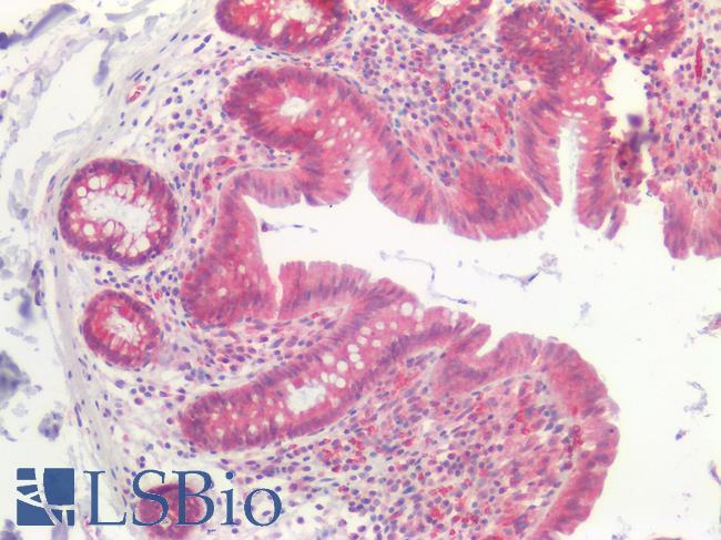 NOX1 Antibody - Human Small Intestine: Formalin-Fixed, Paraffin-Embedded (FFPE)