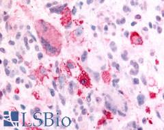 NPBWR2 / GPR8 Antibody - Brain, glioblastoma