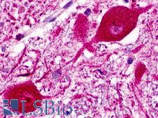 NPFF2 / NPFFR2 Antibody - Brain , Medulla