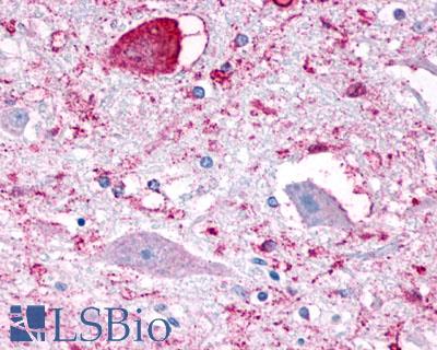 NPFFR1 / GPR147 Antibody - Brain, Medulla, neurons within hypoglossal nucleus