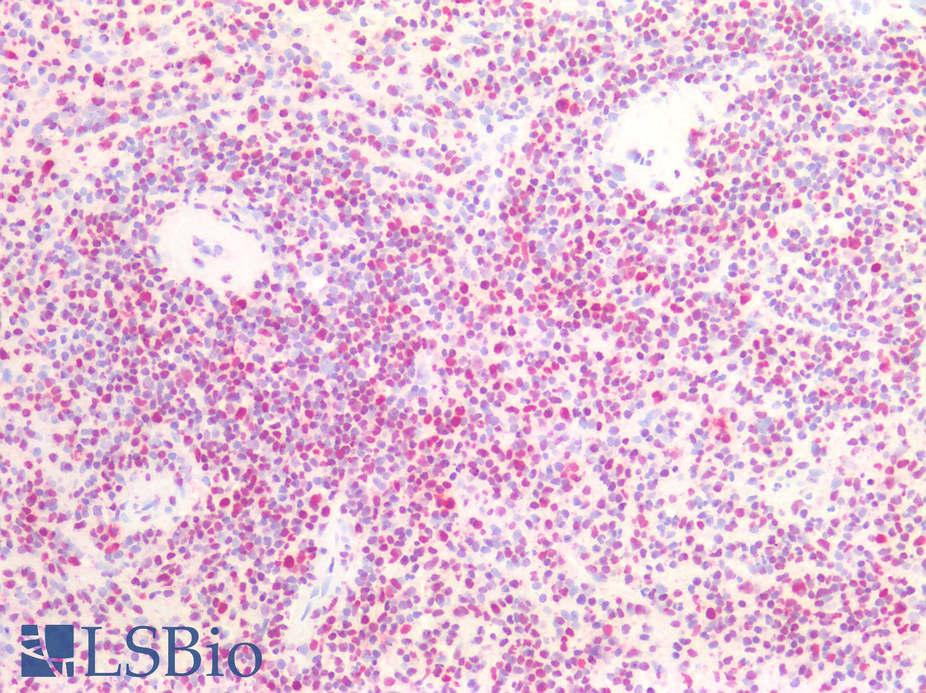 NPM1 / NPM / Nucleophosmin Antibody - Human Spleen: Formalin-Fixed, Paraffin-Embedded (FFPE)