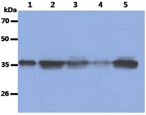NPM1 / NPM / Nucleophosmin Antibody - The Recombinant Human NPM1 (50ng) and Cell lysates (40ug) were resolved by SDS-PAGE, transferred to PVDF membrane and probed with anti-human NPM1 antibody (1:1000). Proteins were visualized using a goat anti-mouse secondary antibody conjugated to HRP and an ECL detection system. Lane 1. : Recombinant Human NPM1 Lane 2. : Jurkat cell lysate Lane 3. : 293T cell lysate Lane 4. : HeLa cell lysate Lane 5. : HepG2 cell lysate