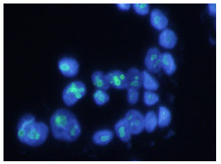 NPM1 / NPM / Nucleophosmin Antibody - ICC/IF analysis of NPM1 in WiDr cells, stained with DAPI (Blue) for nucleus staining and monoclonal anti-human NPM1 antibody (1:200) with goat anti-mouse IgG-Alexa fluor 488 conjugate (Green).