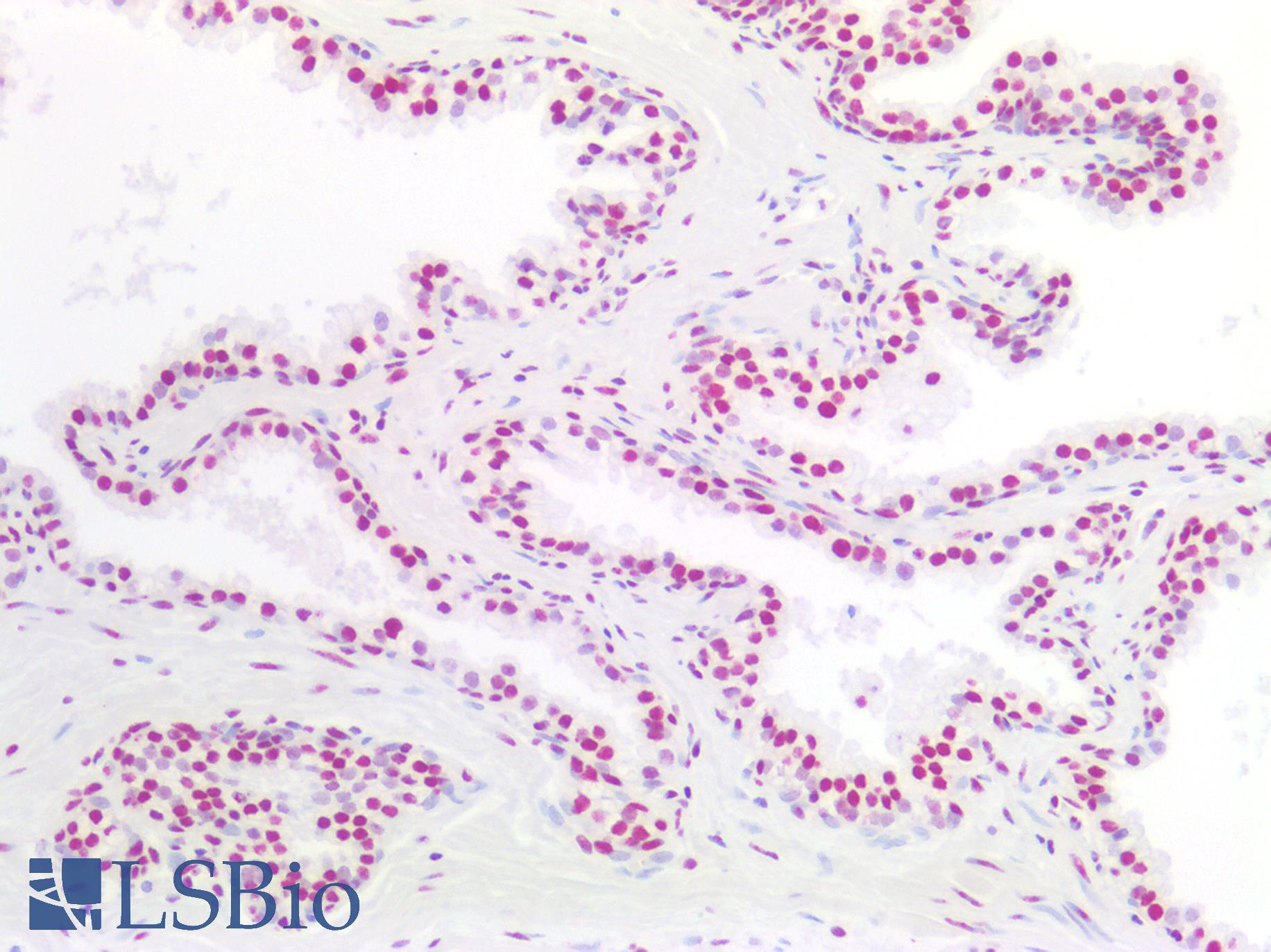 NPM1 / NPM / Nucleophosmin Antibody - Human Prostate: Formalin-Fixed, Paraffin-Embedded (FFPE)