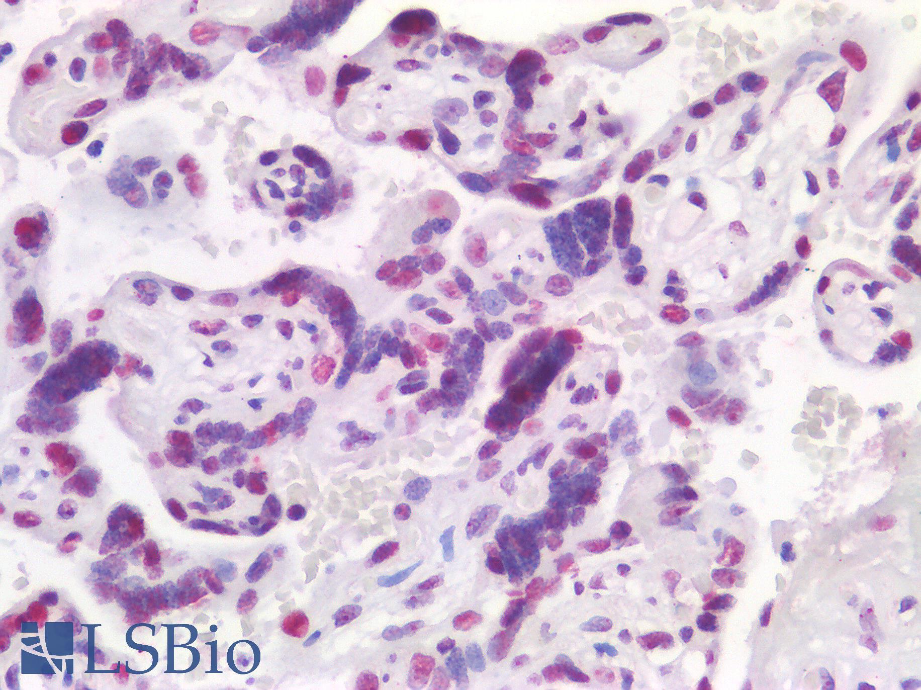 NPM1 / NPM / Nucleophosmin Antibody - Human Placenta: Formalin-Fixed, Paraffin-Embedded (FFPE)