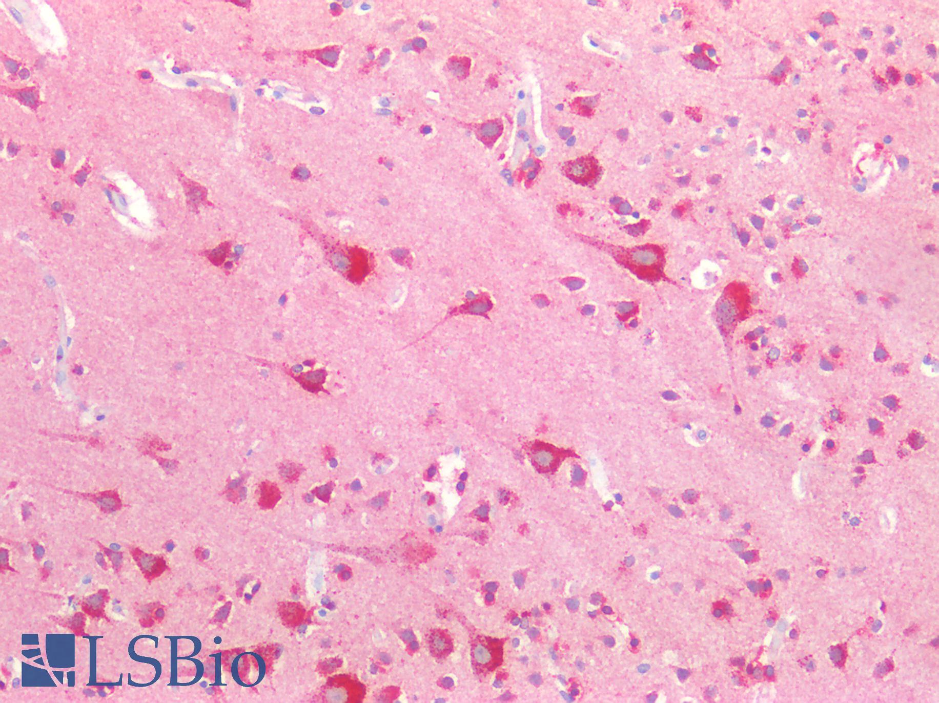 NPTX1 Antibody - Human Brain, Cortex: Formalin-Fixed, Paraffin-Embedded (FFPE)