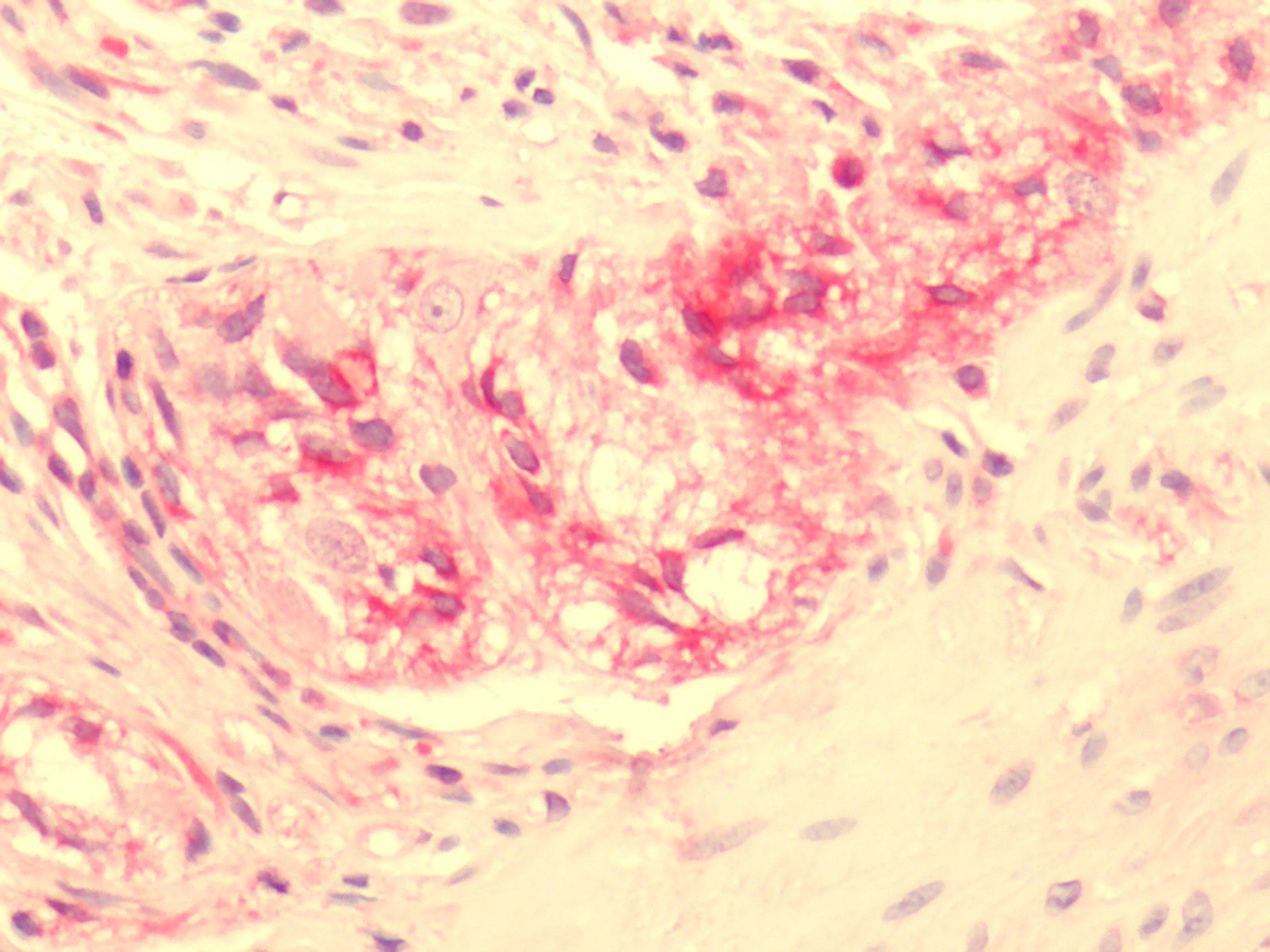NPY2R Antibody - Human Myenteric Plexus Ganglion: Formalin-Fixed, Paraffin-Embedded (FFPE)