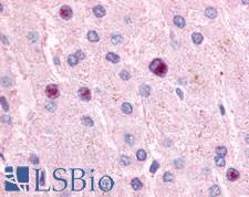 NR0B2 Antibody - Anti-NR0B2 antibody IHC staining of human liver, hepatocytes. Immunohistochemistry of formalin-fixed, paraffin-embedded tissue after heat-induced antigen retrieval.
