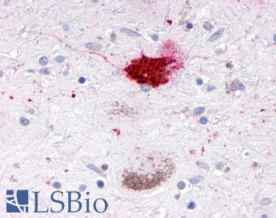 NR1D1 Antibody - Brain, Substantia nigra, pigmented neuron