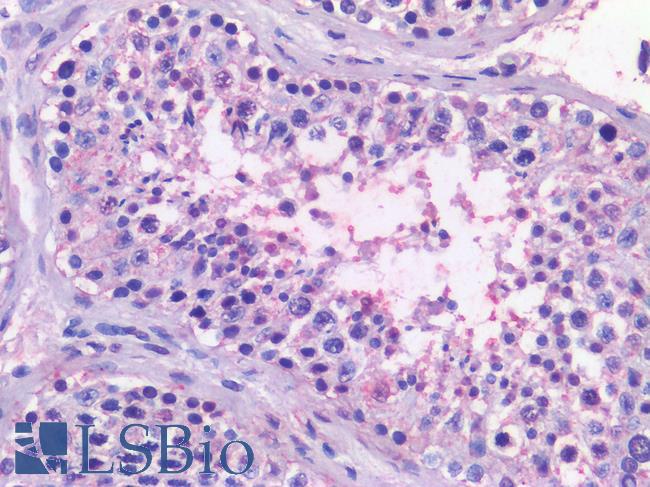 NR5A1 / SF1 Antibody - Human Testis: Formalin-Fixed, Paraffin-Embedded (FFPE)