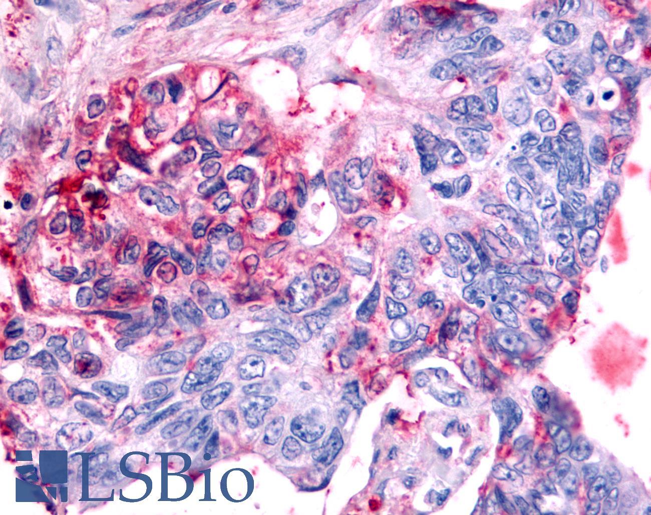 NR6A1 / GCNF Antibody - Colon, carcinoma