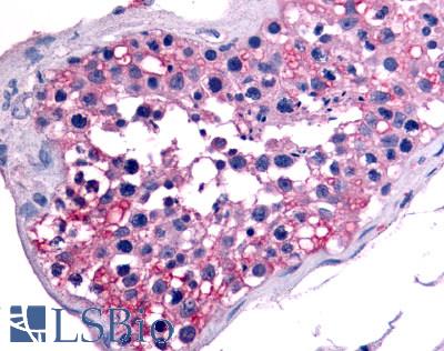 NR6A1 / GCNF Antibody - Anti-NR6A1 / GCNF antibody IHC of human testis. Immunohistochemistry of formalin-fixed, paraffin-embedded tissue after heat-induced antigen retrieval.