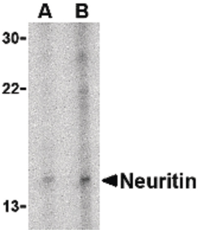 NRN1 / Neuritin Antibody - Western Blot of neuritin in Daudi cell lysate with LS-B535 at (A) 5 and (B) 10 µg/ml.