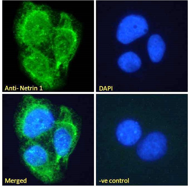 NTN1 / Netrin 1 Antibody - Goat Anti-Netrin 1 Antibody Immunofluorescence analysis of paraformaldehyde fixed U2OS cells, permeabilized with 0.15% Triton. Primary incubation 1hr (10ug/ml) followed by Alexa Fluor 488 secondary antibody (2ug/ml), showing membrane and secreted staining. The nuclear stain is DAPI (blue). Negative control: Unimmunized goat IgG (10ug/ml) followed by Alexa Fluor 488 secondary antibody (2ug/ml).