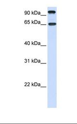 NTRK3 / TRKC Antibody - Fetal liver lysate. Antibody concentration: 1.0 ug/ml. Gel concentration: 12%.  This image was taken for the unconjugated form of this product. Other forms have not been tested.
