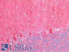 NTRK3 / TRKC Antibody - Human Brain, Cerebellum: Formalin-Fixed, Paraffin-Embedded (FFPE)