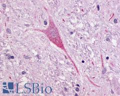 NTSR1 / NTR Antibody - Brain, globus pallidus neuron