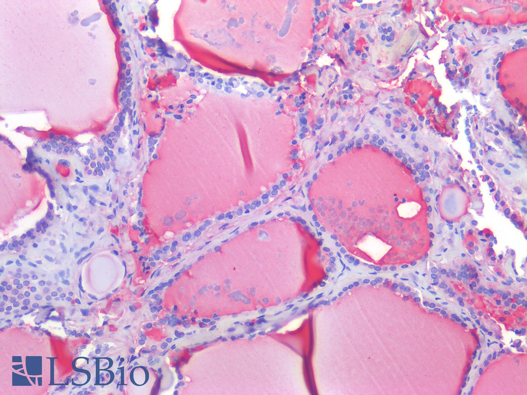 OCLN / Occludin Antibody - Human Thyroid: Formalin-Fixed, Paraffin-Embedded (FFPE)