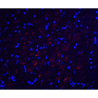 OCLN / Occludin Antibody - Immunofluorescence of OCLN in mouse brain tissue with OCLN antibody at 20 µg/mL.