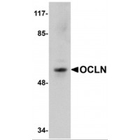 OCLN / Occludin Antibody - Western blot analysis of OCLN in human liver tissue lysate with OCLN antibody at 1 µg/mL.