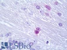 OLIG1 Antibody - Mouse Brain, Cerebellum: Formalin-Fixed, Paraffin-Embedded (FFPE) 