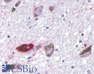 OR10R2 Antibody - Brain, Substantia nigra, pigmented neurons