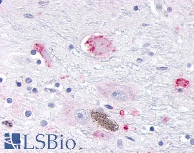 OR10R2 Antibody - Brain, Substantia nigra, pigmented and nonpigmented neurons