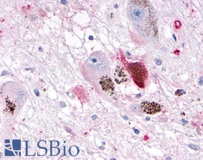 OR10R2 Antibody - Brain, Substantia nigra, pigmented neuron