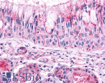 OR2A4 Antibody - Anti-OR2A4 antibody IHC of human nasal mucosa, respiratory epithelium. Immunohistochemistry of formalin-fixed, paraffin-embedded tissue after heat-induced antigen retrieval.