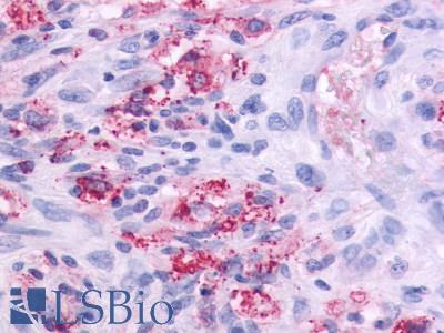 OR51E1 Antibody - Brain, glioblastoma