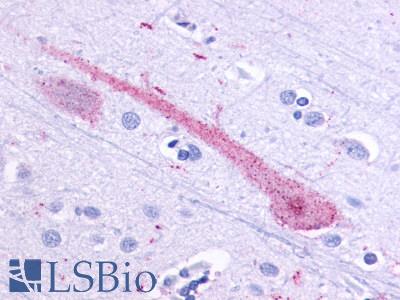 OR51E1 Antibody - Brain, cortex, Neurons