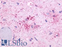 OR51E1 Antibody - Brain, Alzheimer's disease senile plaque