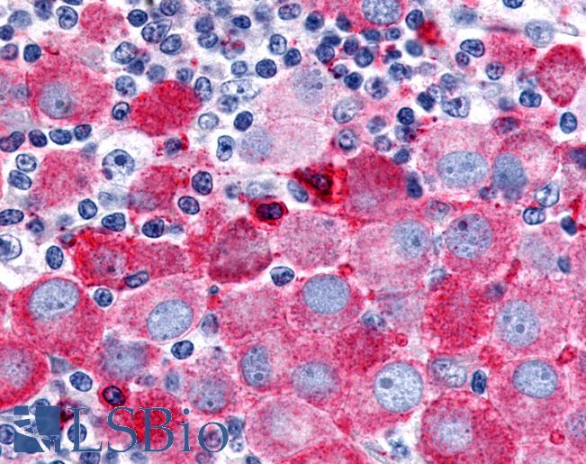 OR51E2 / PSGR Antibody - Skin, Malignant Melanoma