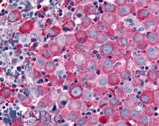 OR51E2 / PSGR Antibody - Skin, Malignant Melanoma