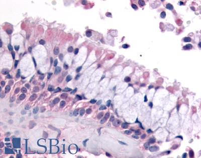 OR6K3 Antibody - Anti-OR6K3 antibody IHC of human nasal mucosa, respiratory epithelium. Immunohistochemistry of formalin-fixed, paraffin-embedded tissue after heat-induced antigen retrieval.