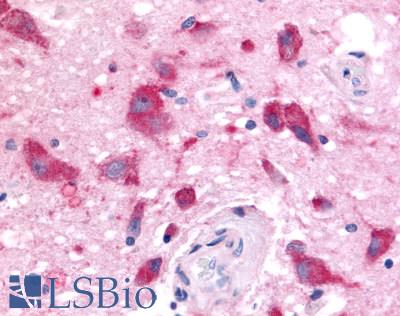 OR6N1 Antibody - Brain, Thalamus, neurons and glia