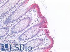 p16INK4a / CDKN2A Antibody - Human Colon: Formalin-Fixed, Paraffin-Embedded (FFPE)