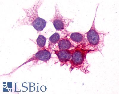 P2RY14 / GPR105 Antibody - Anti-P2RY14 / P2Y14 antibody immunocytochemistry (ICC) staining of HEK293 human embryonic kidney cells transfected with P2RY14 / P2Y14.