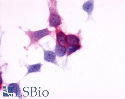 P2RY6 / P2Y6 Antibody - Anti-P2RY6 / P2Y6 antibody immunocytochemistry (ICC) staining of HEK293 human embryonic kidney cells transfected with P2RY6 / P2Y6.