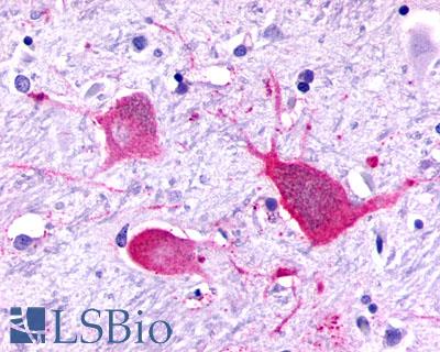 P2RY8 / P2Y8 Antibody - Brain, Thalamus