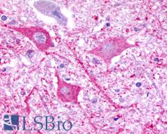 P2RY8 / P2Y8 Antibody - Brain, Medulla